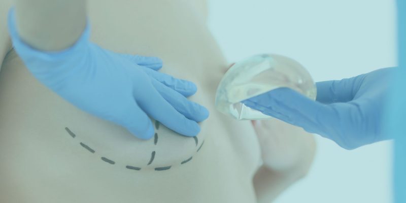 SERVICIOS_BUSTO_BANNER
